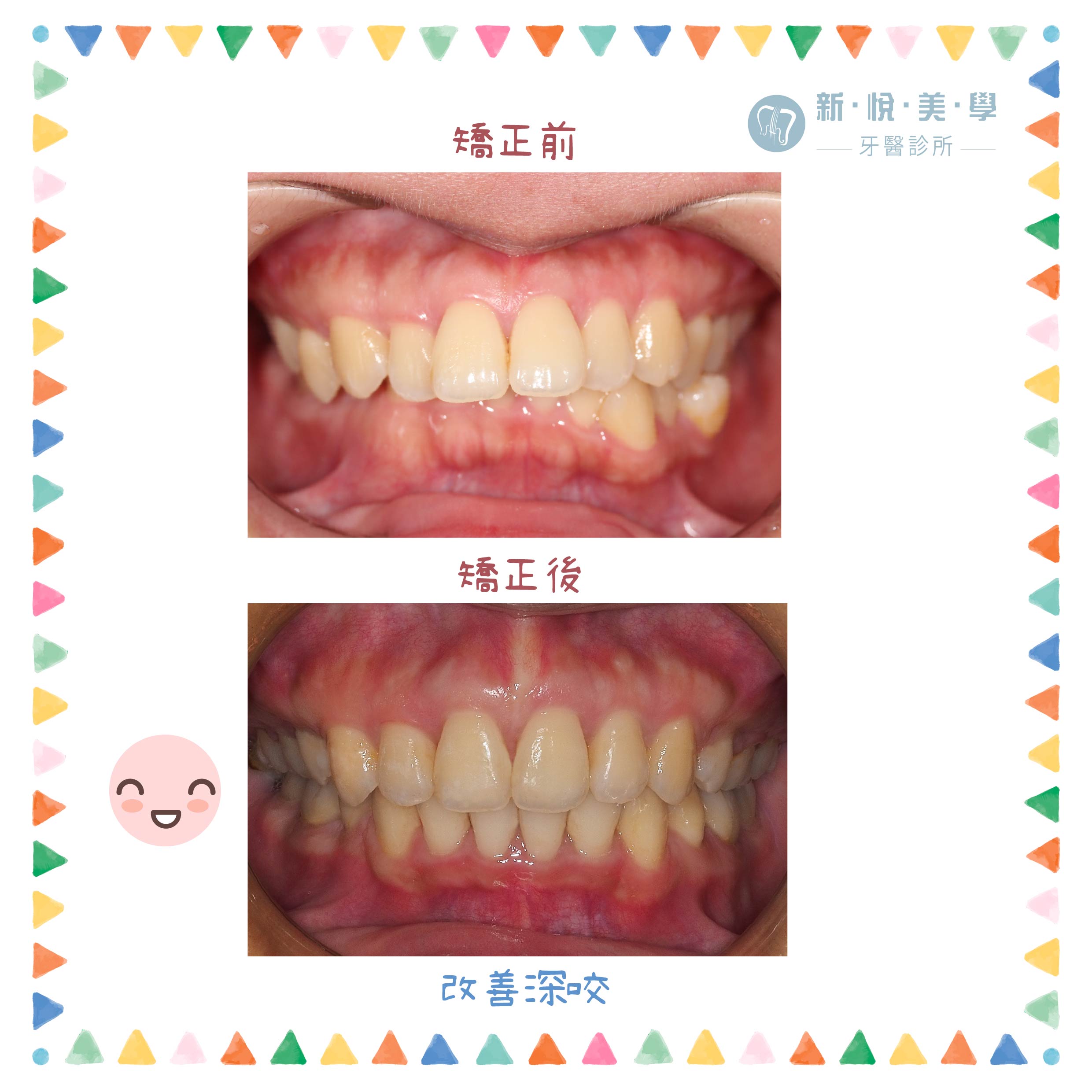 恭喜！吳之華醫師矯正班畢業囉的第3張圖片
